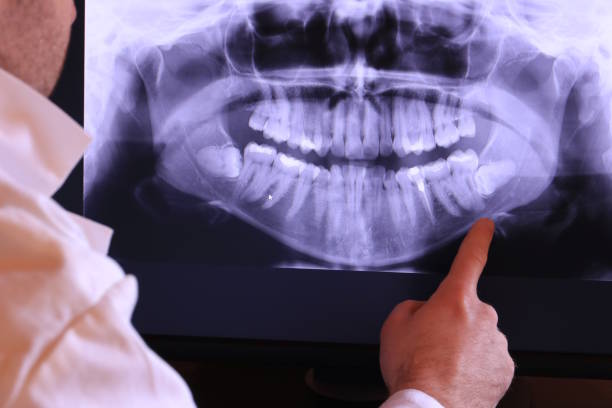 Best Weekend Emergency Dentist in East Sonora, CA